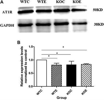 The Role of Nrf2 in the PM-Induced Vascular Injury Under Real Ambient Particulate Matter Exposure in C57/B6 Mice